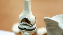 Вячеслав Гладков призвал белгородцев пройти опрос о доступности эндопротезирования суставов