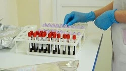 Врач Ирина Николаева: диагностика ВИЧ-инфекции на ранней стадии уменьшает круг потенциальных больных